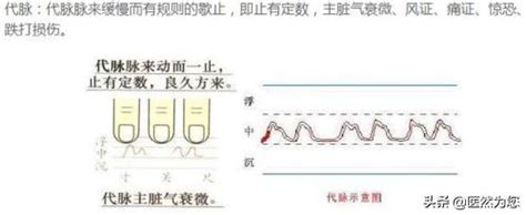 脈細數|【脈象學說】十二種常見脈象簡述